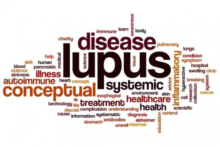 Lupus Symptoms Explained: What to Watch For and When to Seek Help