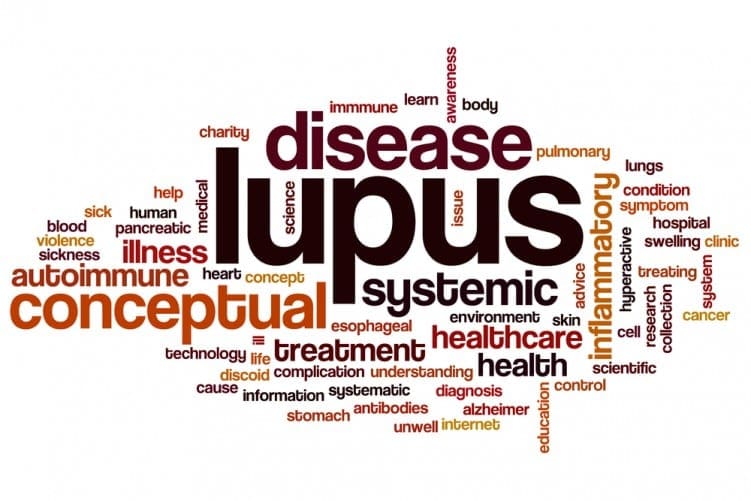 Lupus Symptoms Explained: What to Watch For and When to Seek Help
